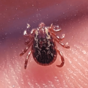 American dog ticks